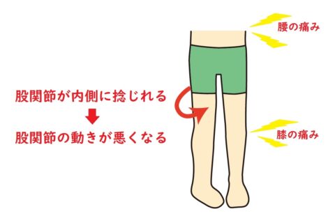 足組のクセは膝痛や腰痛を起こしやすい